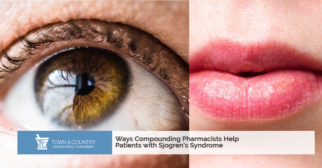 Ways Compounding Pharmacists Help Patients with Sjogren's Syndrome
