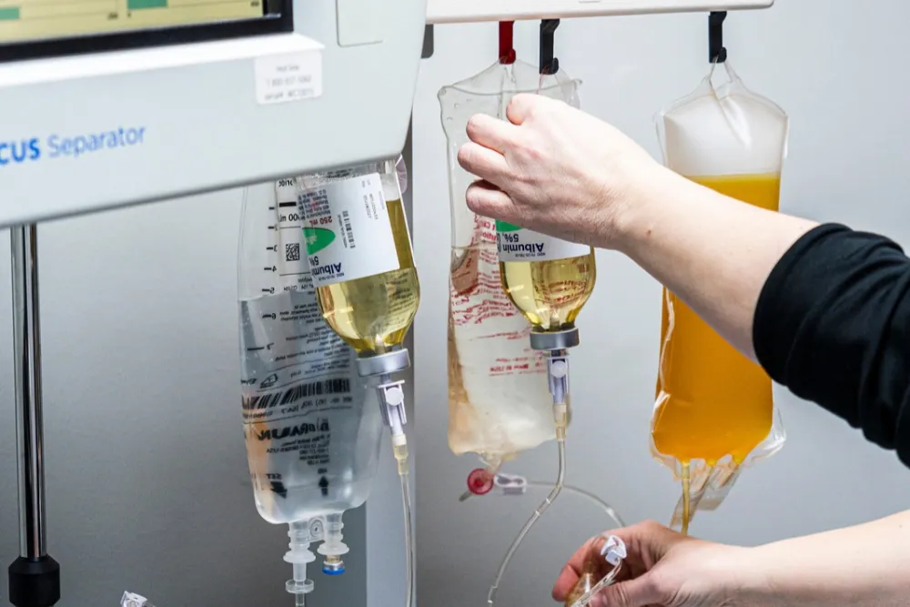 Advanced Serial TPE Plasma Exchange New Jersey New York