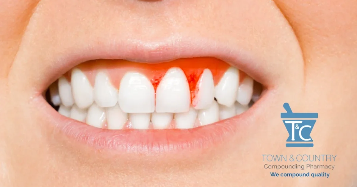 perio-gel-hydrogen-peroxide-mouth-rinse-compounding-pharmacy-near-me-new-jersey-new-york-nyc